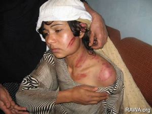 Violence Against Afghanistan Women Have Risen 30% in 2012